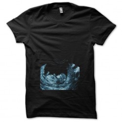 T-shirt echography pregnant woman black sublimation
