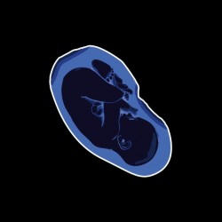 T-shirt Blue Fetus black sublimation